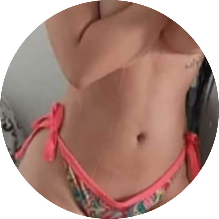 Resultado Real - Vaser HD