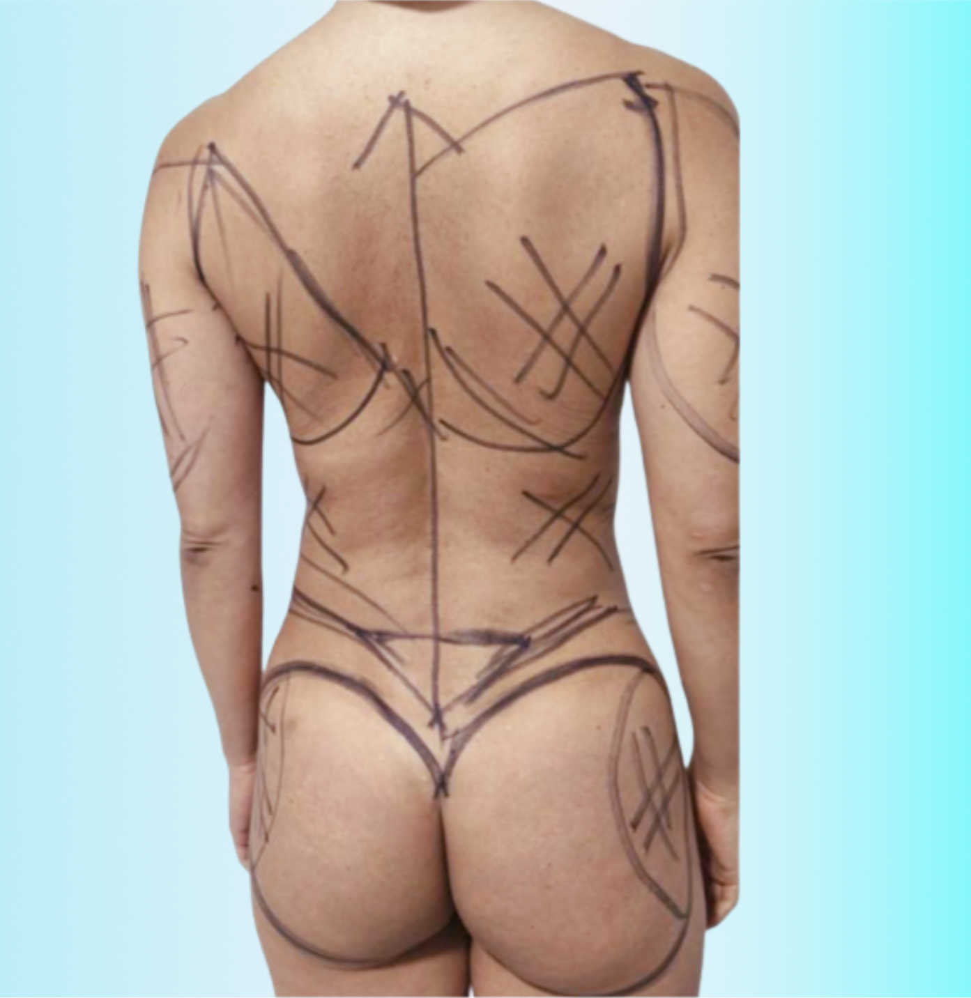 Rejuvenecimiento Antes