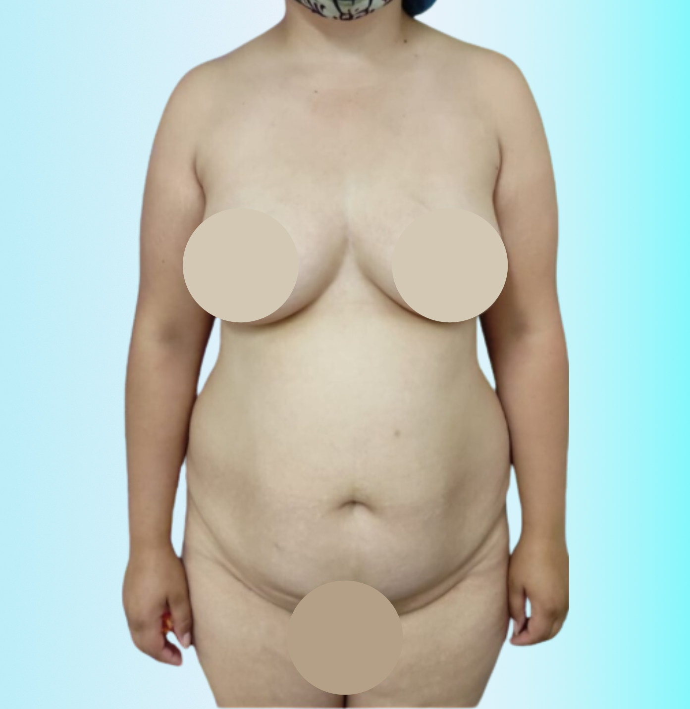 Piel de Porcelana Antes