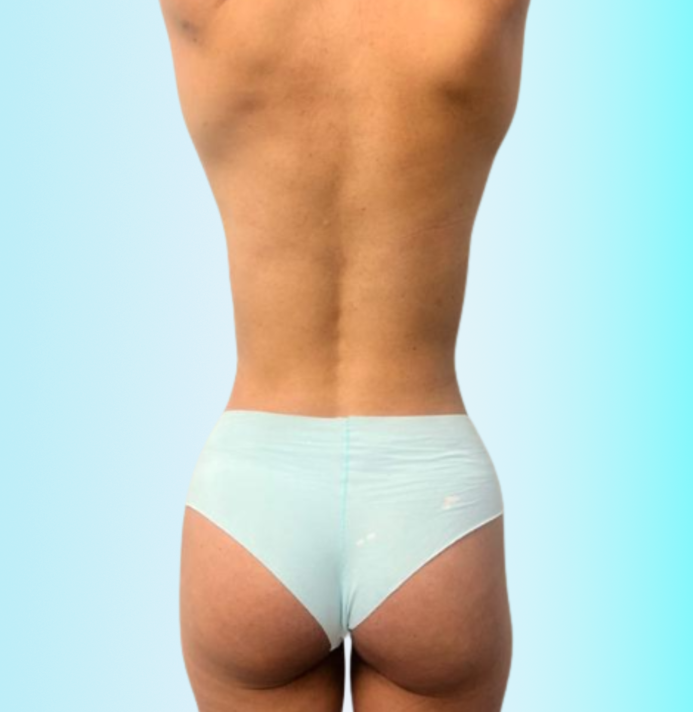 Rejuvenecimiento Despues