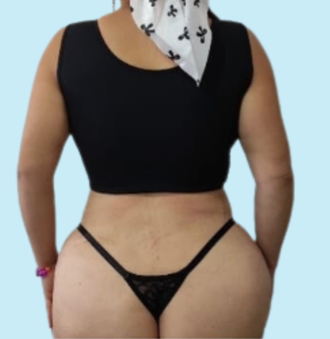 Lipopapada HD Despues