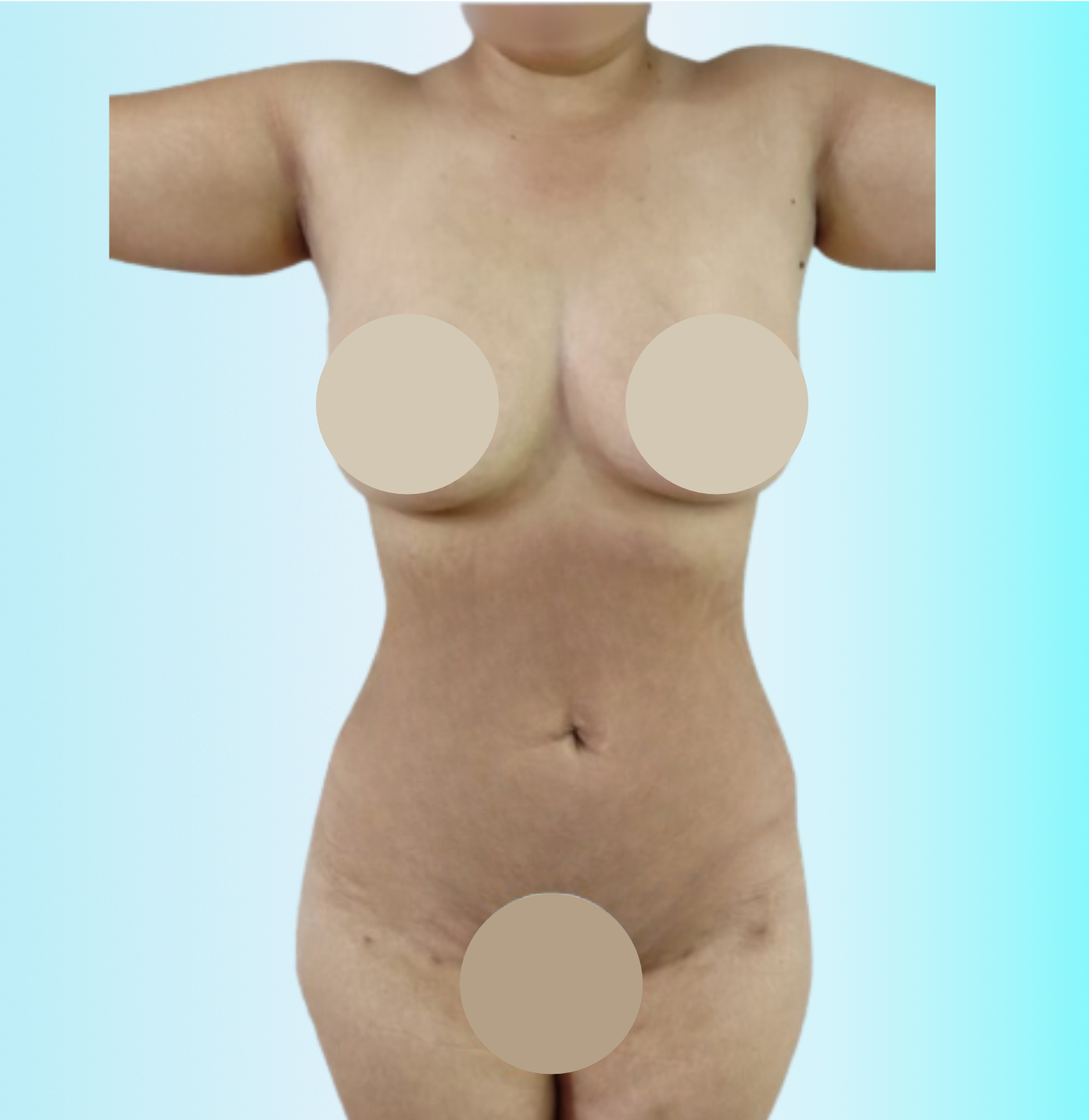 Piel de Porcelana Despues